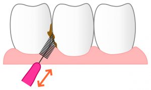 歯間ブラシ使い方