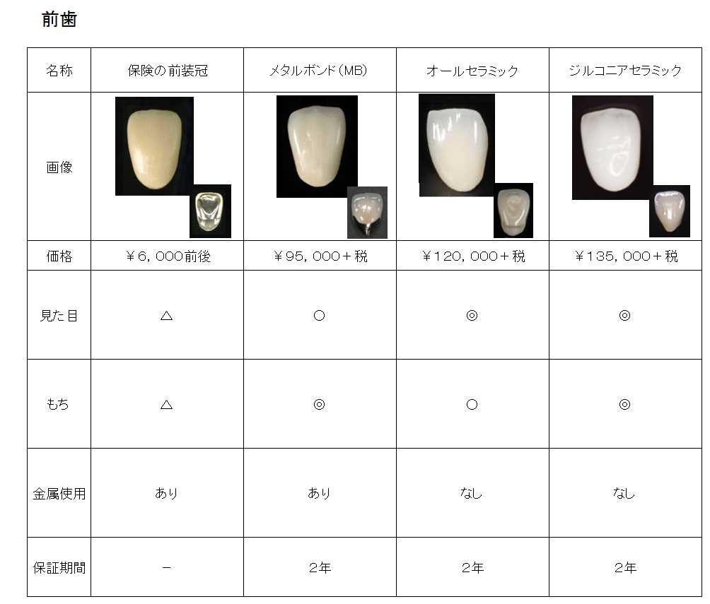 前歯のかぶせ物の種類と治療費