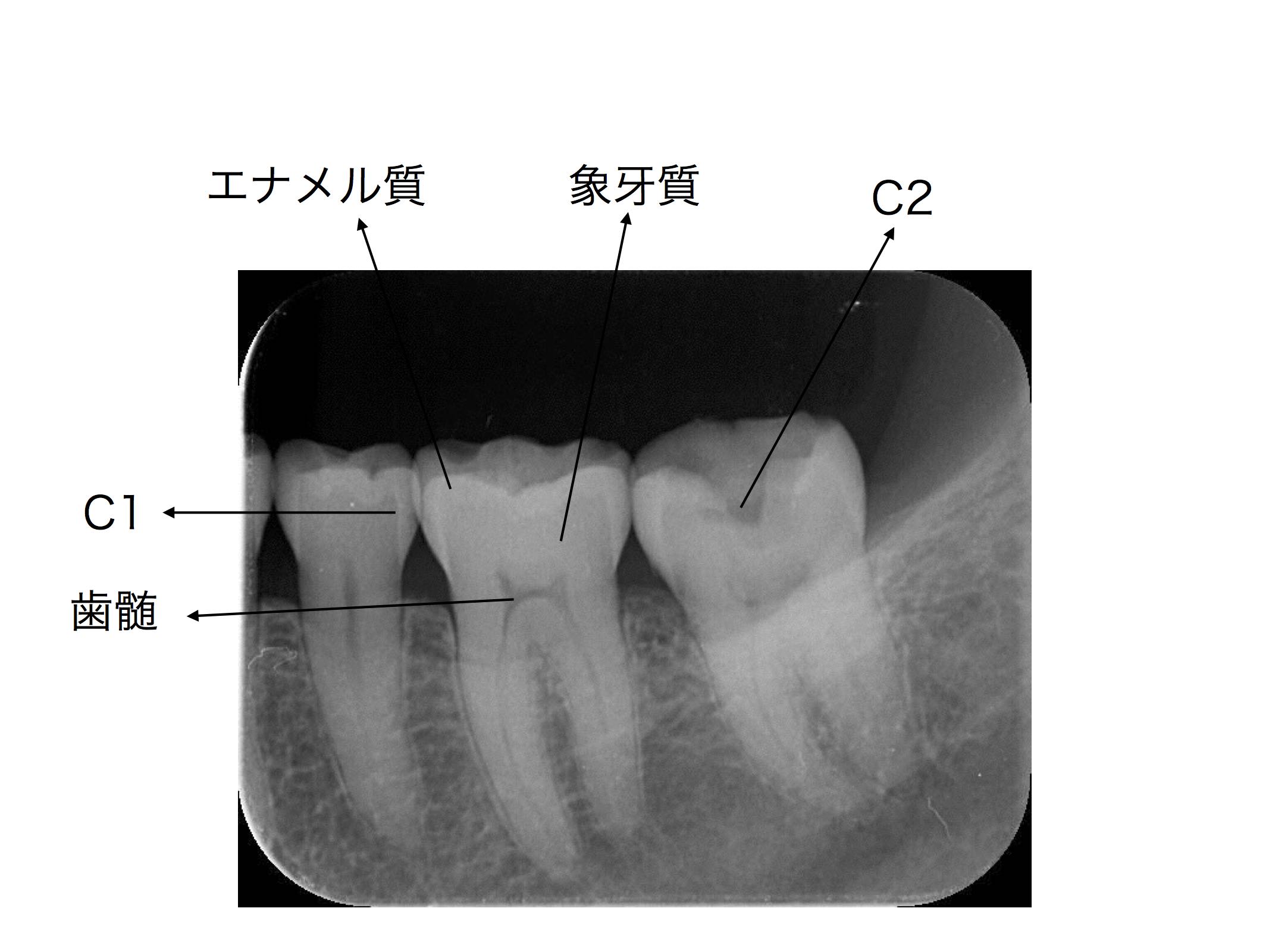 健康な歯の見方