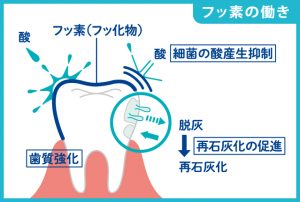 フッ素の働き再石灰化