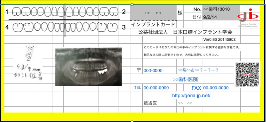 インプラントカード