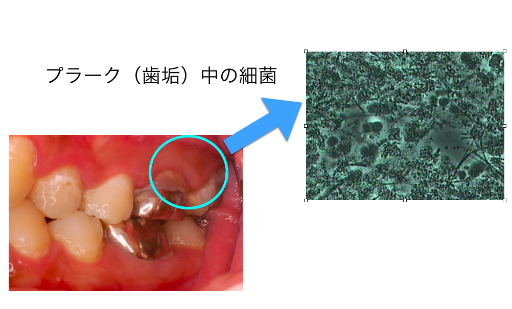 プラーク細菌