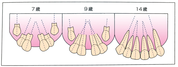 正中離開　歯のはえかわり