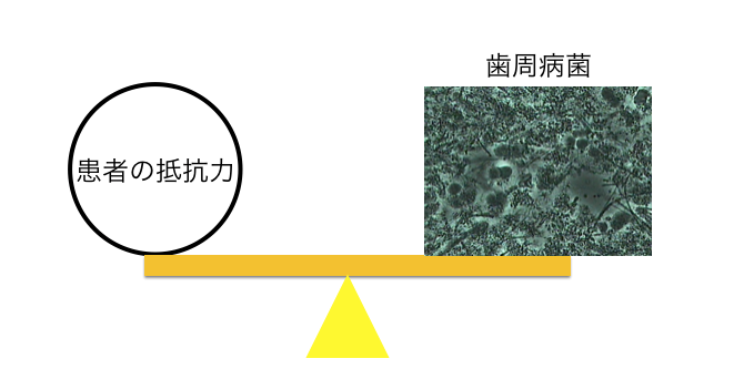 歯周病　本質