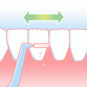 歯間ブラシ使い方
