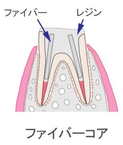 ファイバーコアイラスト