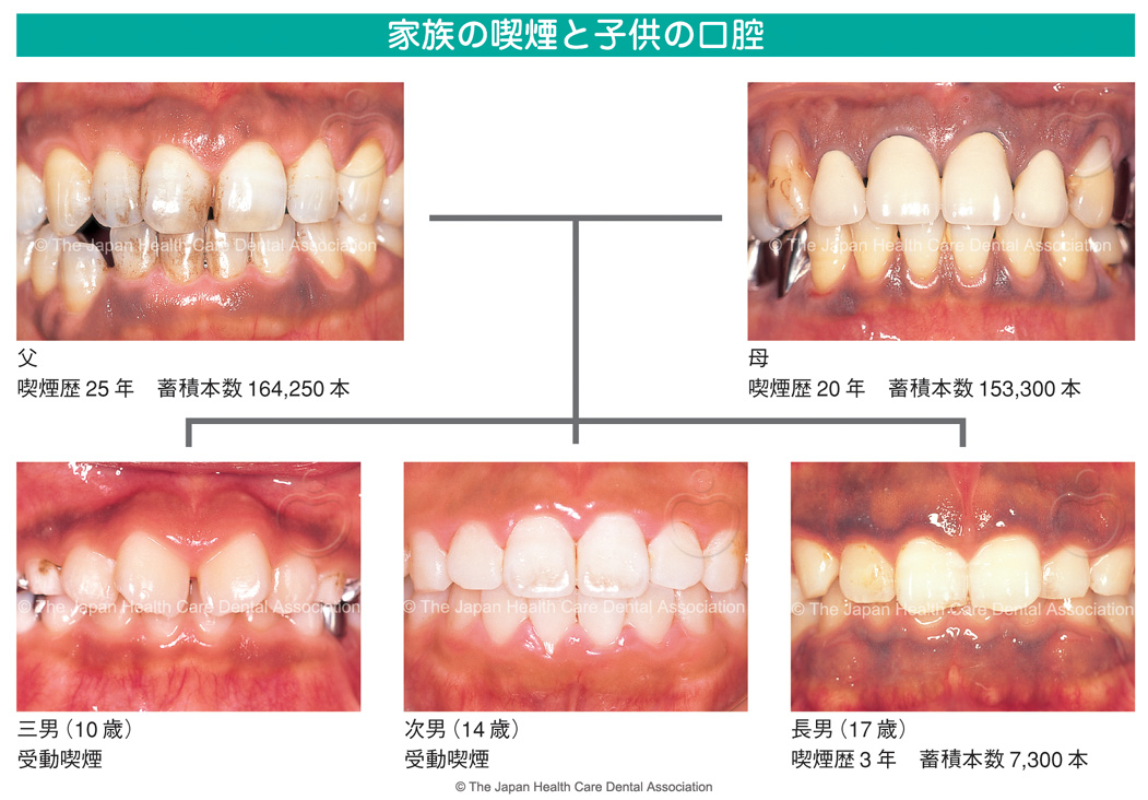 受動喫煙