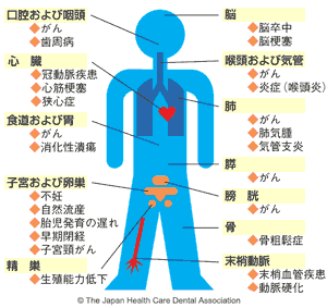 タバコ全身疾患