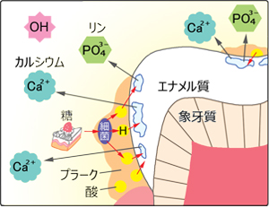 脱灰のしくみのイラスト