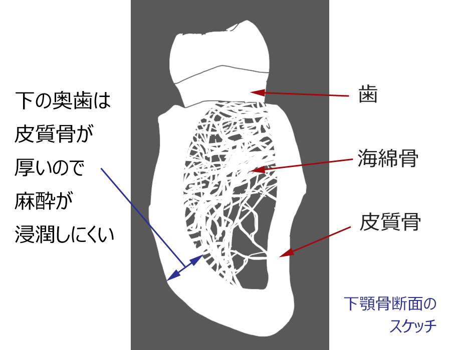 下顎骨断面