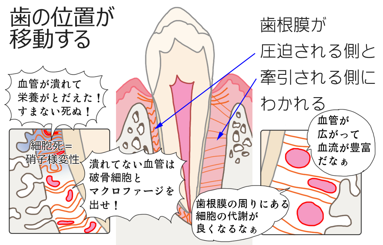 矯正における骨改造