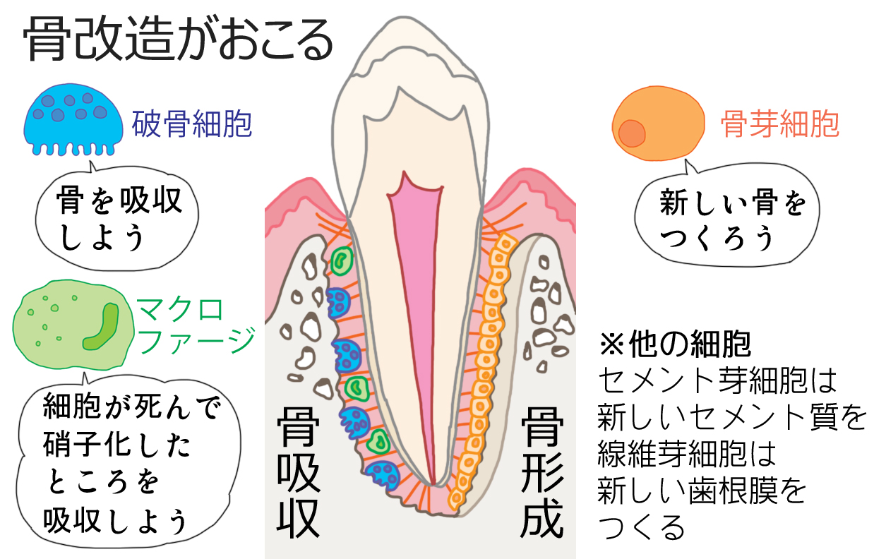 矯正における骨改造