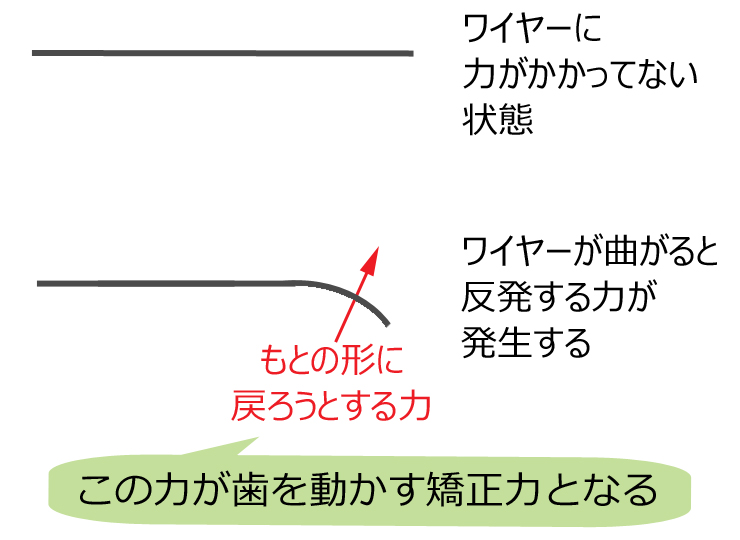 ワイヤーの矯正力