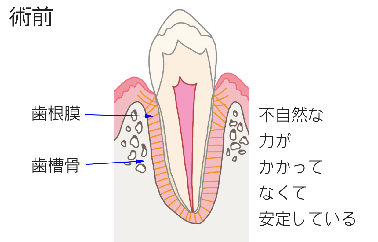 矯正　術前