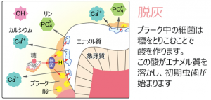 脱灰