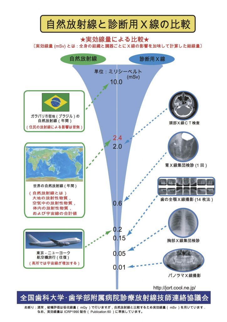 レントゲンの被ばく量の説明