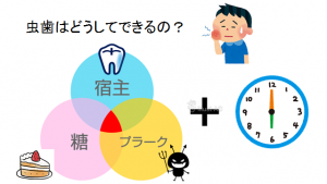 虫歯の原因①