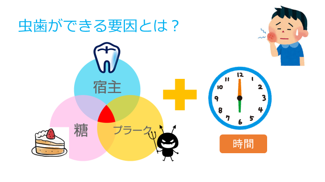 虫歯ができる要因とは