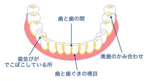 歯磨き方法６