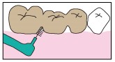 歯間ブラシ　使い方