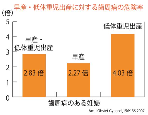 歯周病と早産の関係