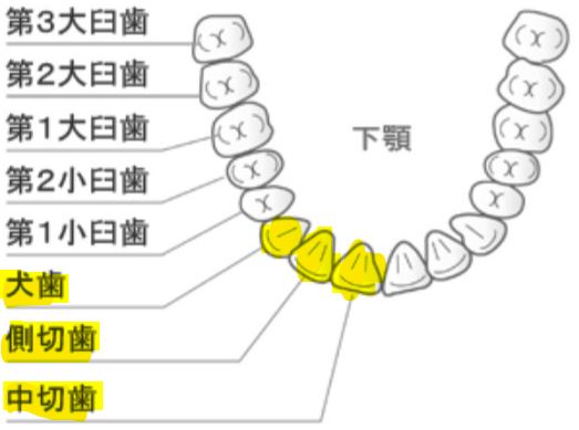 癒合歯