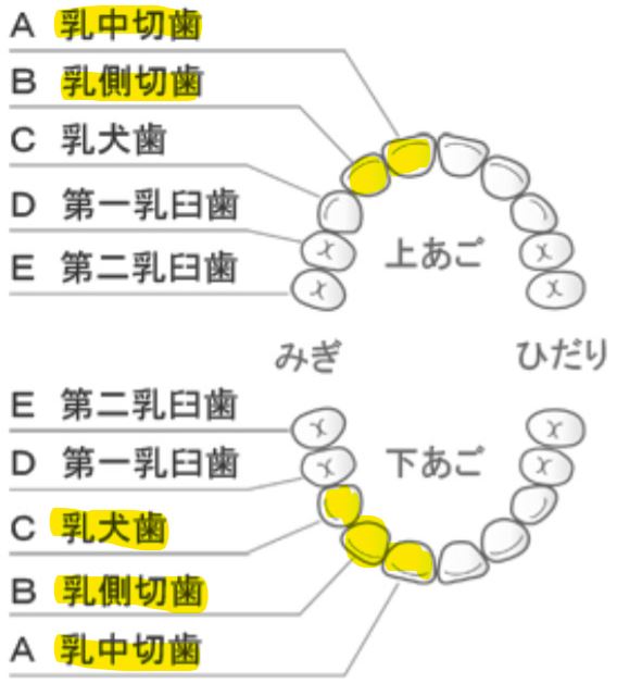 癒合歯