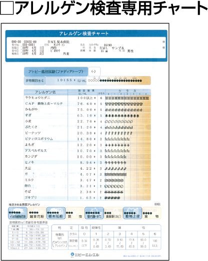 アレルギー検査