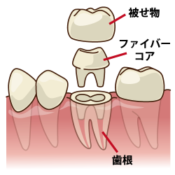 歯のイラスト